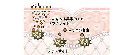 メラノサイトの活性化を抑制
